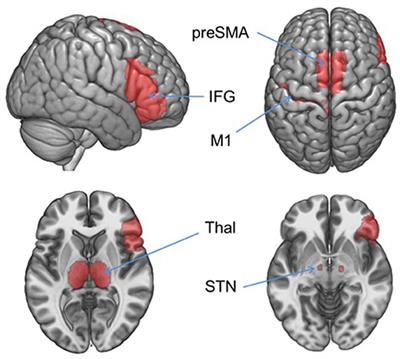 Associations Between Smoking Abstinence, Inhibitory Control, and Smoking Behavior: An fMRI Study